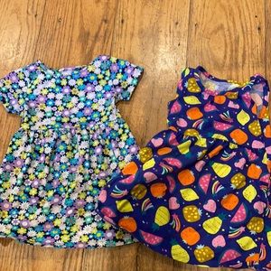 2t summer dress bundle